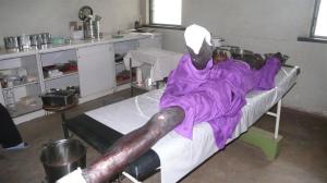 Johns Amputaionswunde muss gereinigt werden.